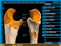 Ulna